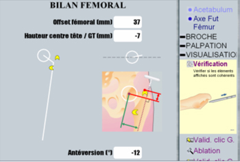 Ecran d'ordinateur pendant l'intervention